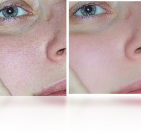 图片[2]-CleanSkinFX 1.0-外行下载站