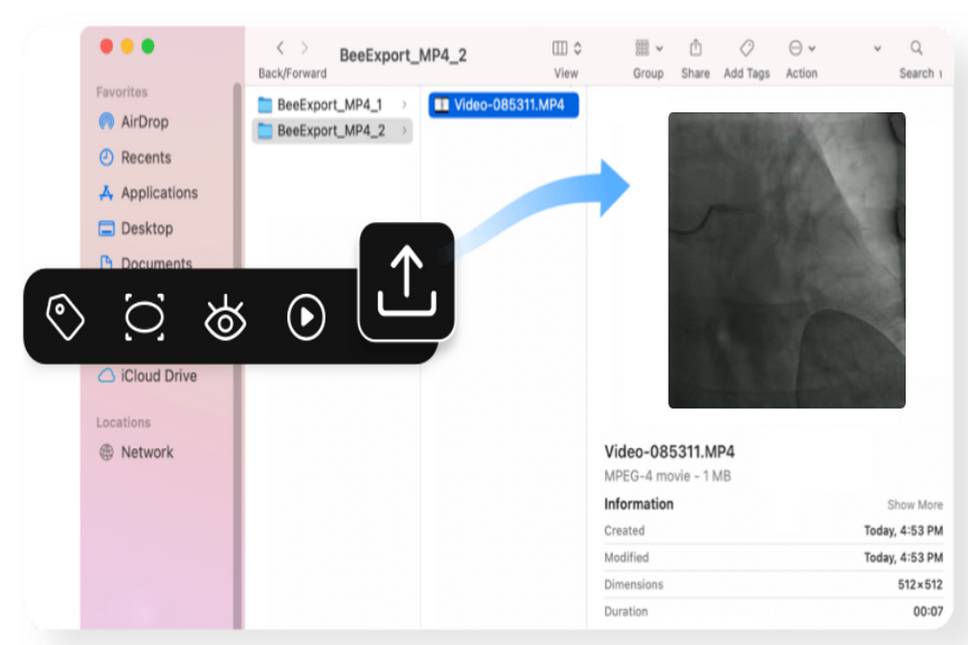图片[2]-小赛看看 DICOM Viewer 3.7.2.11397-外行下载站