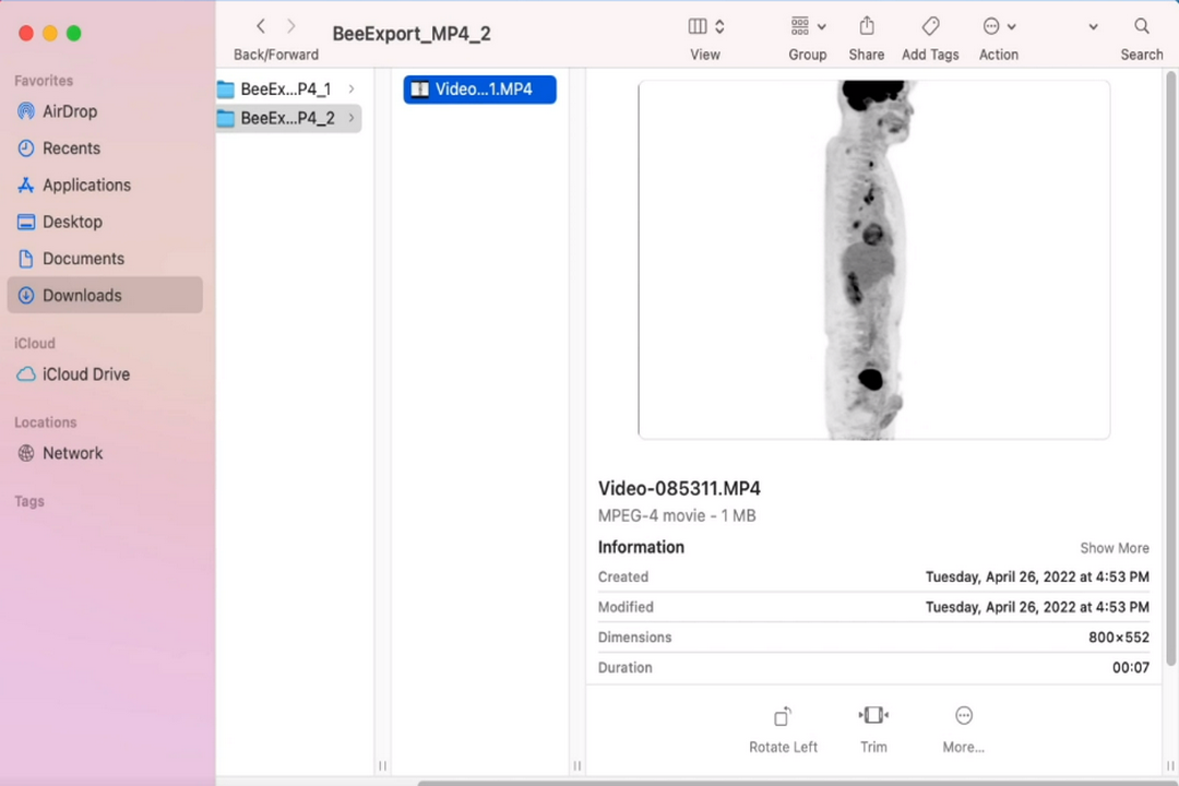 图片[3]-小赛看看 DICOM Viewer 3.7.2.11397-外行下载站