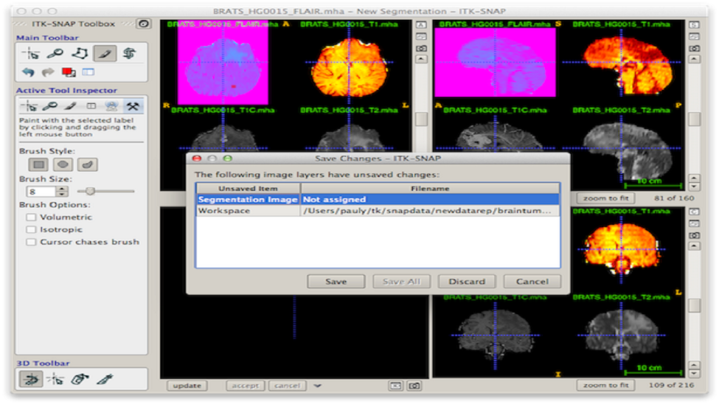 图片[3]-ITK-SNAP 0.1.1-外行下载站